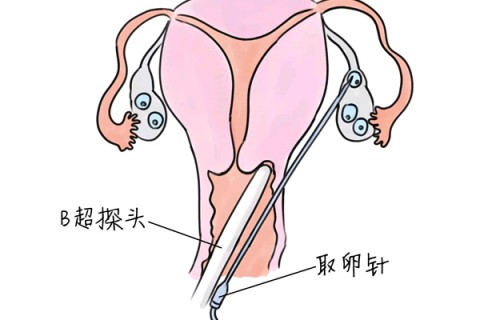 http://beijing.vdtfzz.com/post/205.html|北京供卵助孕